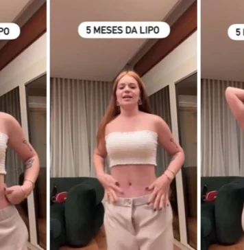 Viih Tube comemora resultados de cirurgias estéticas após cinco meses Design sem nome 6.webp